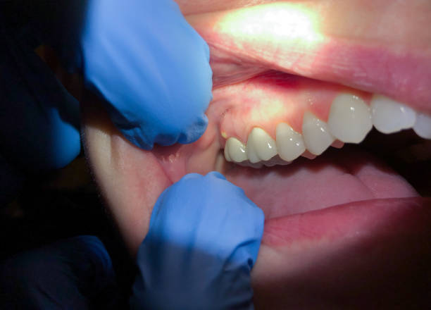 Best Mobile Emergency Dentist in Wilkesboro, NC