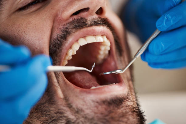 Best Orthodontic Emergency Dentist in Wilkesboro, NC